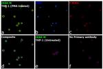 IRAK-M Antibody