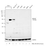 IRAK-M Antibody