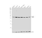 RhoGDI Antibody in Western Blot (WB)