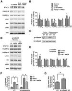 Calpain 2 Antibody in Western Blot (WB)