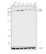 Acetyl-CoA Carboxylase Antibody in Western Blot (WB)