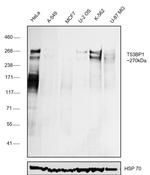 53BP1 Antibody in Western Blot (WB)