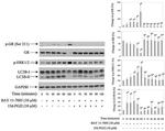 Phospho-Glucocorticoid Receptor (Ser211) Antibody in Western Blot (WB)