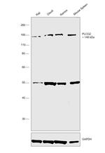 PLCG2 Antibody in Western Blot (WB)