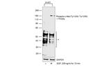 Phospho-c-Met (Tyr1234, Tyr1235) Antibody in Western Blot (WB)