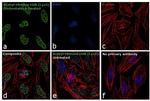 H2BK5ac Antibody