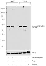 Phospho-SRC (Tyr527) Antibody in Western Blot (WB)