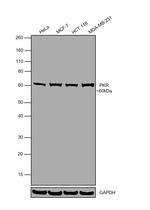 PKR Antibody in Western Blot (WB)