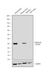 DARPP-32 Antibody in Western Blot (WB)