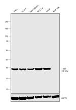 SET Antibody in Western Blot (WB)