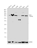 CDT1 Antibody in Western Blot (WB)