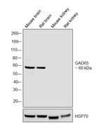 GAD65 Antibody in Western Blot (WB)