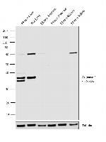 Arginase 1 Antibody in Western Blot (WB)