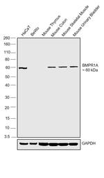 BMPR1A Antibody in Western Blot (WB)