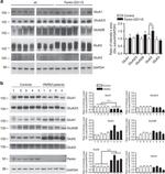 NMDAR2B Antibody in Western Blot (WB)