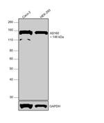 AS160 Antibody in Western Blot (WB)