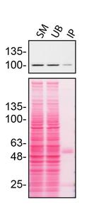 ITCH Antibody in Immunoprecipitation (IP)