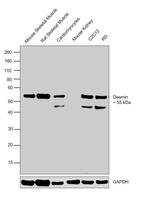 Desmin Antibody in Western Blot (WB)