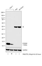 S100A9 Antibody in Western Blot (WB)