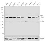 SNX1 Antibody in Western Blot (WB)