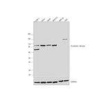 PLA2G4A Antibody in Western Blot (WB)