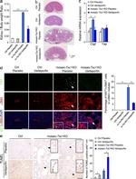 Ki-67 Antibody in Immunohistochemistry (Paraffin) (IHC (P))