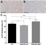 Ki-67 Antibody in Immunohistochemistry (IHC)