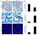 Ki-67 Antibody in Immunohistochemistry (Paraffin) (IHC (P))