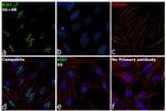 Ki-67 Antibody