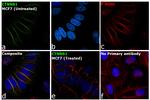 beta Catenin Antibody