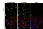 PADI2 Antibody in Immunocytochemistry (ICC/IF)