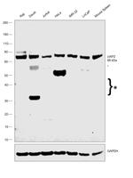 cIAP2 Antibody in Western Blot (WB)