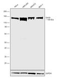 DHX9 Antibody in Western Blot (WB)