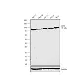 EEF2 Antibody in Western Blot (WB)