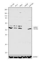 ZIPK Antibody