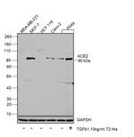 ACE2 Antibody in Western Blot (WB)