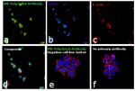 Btk Antibody in Immunocytochemistry (ICC/IF)