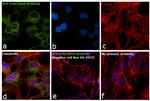 BIK Antibody in Immunocytochemistry (ICC/IF)