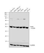 Lass6 Antibody in Western Blot (WB)