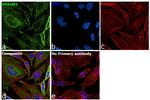 SQSTM1 Antibody in Immunocytochemistry (ICC/IF)