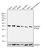 SQSTM1 Antibody in Western Blot (WB)