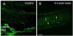 CIITA Antibody in Immunohistochemistry (IHC)