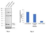 HPRT1 Antibody in Western Blot (WB)