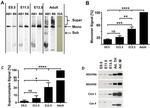 UQCRC1 Antibody in Western Blot (WB)