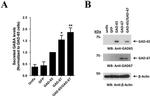 GAD67 Antibody in Western Blot (WB)