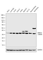 ARPC2 Antibody in Western Blot (WB)