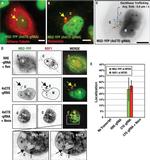 TAP Antibody in Immunocytochemistry (ICC/IF)