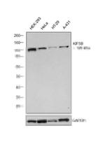 Kinesin 5B Antibody in Western Blot (WB)