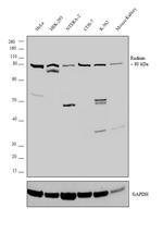 Radixin Antibody in Western Blot (WB)