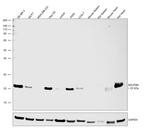 NDUFB9 Antibody in Western Blot (WB)